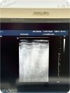 PHILIPS Model IU22 Diagnostic Ultrasound System