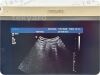 PHILIPS Model IU22 Diagnostic Ultrasound System