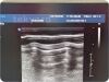 PHILIPS Model IU22 Diagnostic Ultrasound System