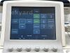 PHILIPS Model IU22 Diagnostic Ultrasound System