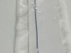 TERUMO Lot of 10 Radial TIG 4.5  40-5014   Exp.2020-10  (Z3) Radial TIG 4.5