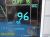 GE 2006  Dash 3000,(Masimo SpO2,CO,T/CO,IBP,NBP & ECG) W/ NEW Leads~ Monitor