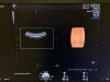 GE Voluson E8 BT19 Ultrasound - OB / GYN - Vascular