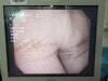 OLYMPUS TJF-Q180V Video Duodenoscope Endoscope
