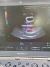 GE Voluson I Ultrasound Machine