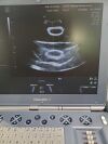 GE Voluson I Ultrasound Machine