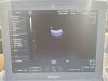 GE Voluson I Ultrasound Machine