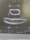 GE Voluson I Ultrasound Machine