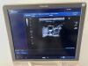 TOSHIBA Aplio Artida Ultrasound - Shared Service