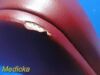 GLOBAL SURGICAL Model SMR 22000 Apex Exam Chair