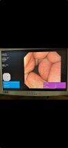 OLYMPUS GIF-XP190N Gastroscope