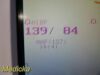 GE 250CX Series 259CX-A Fetal Monitor; US+TOCO Transducers Leads Clicker