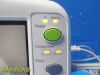 GE 2007  Dash 3000 (NBP,Temp,SpO2,ECG) Patient Monitor