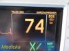 GE 2007  Dash 3000 (NBP,Temp,SpO2,ECG) Patient Monitor