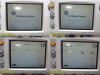 GE/COROMETRICS GE 250 Series Model 259C, US+Toco Transducer, NBP SPO2 Leads~ Fetal Monitor
