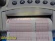 GE/COROMETRICS GE 250 Series 259A,W/ Event Clicker, Transducers & Leads ~ Fetal Monitor