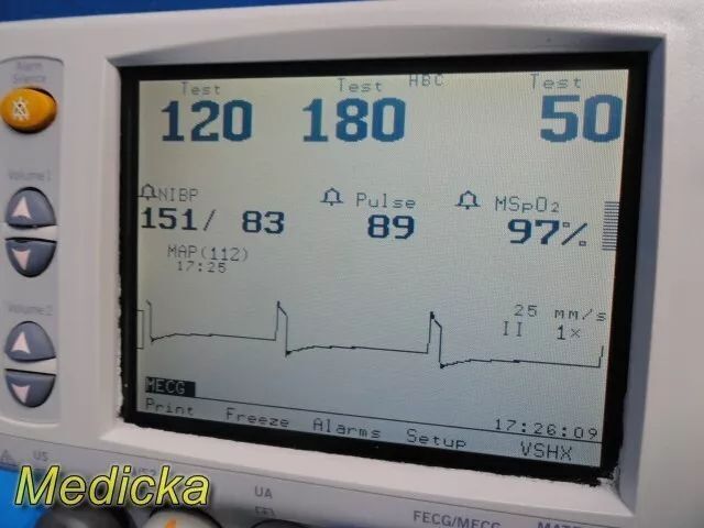 GE/COROMETRICS GE 250 Series 259A,W/ Event Clicker, Transducers & Leads ~ Fetal Monitor