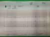 GE MAC 2000 12 Lead Resting EKG ECG System