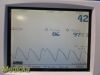 GE/COROMETRICS GE 250 Series 259C ,W/ NEW US & Toco Transducers ~ Maternal Fetal Monitor