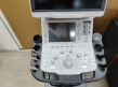 TOSHIBA Aplio 500 Platinum Edition Ultrasound system