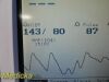 GE/COROMETRICS GE 259C ,W/ 02 Transducers, NBP & SPO2 Leads, Masimo~ Maternal Fetal Monitor