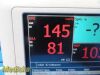 PHILIPS VS3 SureSigns 863073 Spot Vitals Monitor