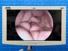 KARL STORZ IMAGE 1 Hub 222010 20 Laparoscope