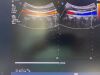 PHILIPS V6-2 Broadband Curved Volume Array Transducer, Volumetric Probe ~ Ultrasound Transducer