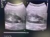 PHILIPS V6-2 Broadband Curved Volume Array Transducer, Volumetric Probe ~ Ultrasound Transducer
