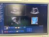 PHILIPS V6-2 Broadband Curved Volume Array Transducer, Volumetric Probe ~ Ultrasound Transducer