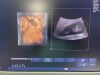 PHILIPS V6-2 Broadband Curved Volume Array Transducer, Volumetric Probe ~ Ultrasound Transducer