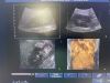 PHILIPS V6-2 Broadband Curved Volume Array Transducer, Volumetric Probe ~ Ultrasound Transducer