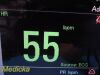 DATASCOPE 0998-00-0170-0014A Passport 2 Coloured Patient Monitor
