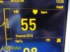 DATASCOPE Passport 2LT,W/ Leads (NBP, ECG, SpO2 Masimo) ~ Patient Monitor