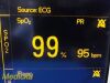 DATASCOPE Passport 2LT,W/ Leads (NBP, ECG, SpO2 Masimo) ~ Patient Monitor