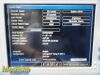 PHILIPS VS3 Sure Signs 863073 Spot  (SPO2,TEMP,NBP) W/ Leads~ Vitals Monitor