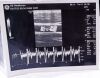 GE L8-18i-D Ultrasound Transducer