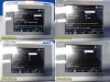 EDAN 2016  Wallach Fetal 2EMR Model F3 Fetal Monitor
