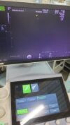 GE Voluson E8 BT 16 Ultrasound - OB / GYN