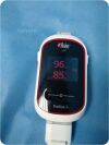MASIMO Radius-7 Cooximeter
