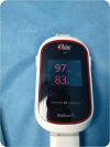 MASIMO Radius-7 Cooximeter
