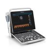 MINDRAY Z60 Portable Ultrasound