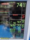 GE Dash 5000,(IPB, NBP, ECG, SpO2, TEMP) W/ NEW Patient Leads ~ Monitor