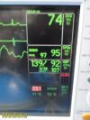 GE Dash 3000 (NBP,Temp,SpO2,ECG & Print) &Accessory Leads~Patient Monitor