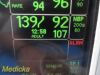 GE Dash 3000 (NBP,Temp,SpO2,ECG & Print) &Accessory Leads~Patient Monitor