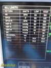 GE Dash 3000 (NBP, Temp, SpO2 & ECG) Patient Monitor