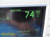GE Dash 3000 (NBP, Temp, SpO2 & ECG) Patient Monitor