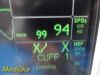 GE Dash 3000 (NBP, Temp, SpO2 & ECG) Patient Monitor