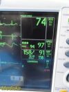 GE Dash 3000 (NBP, Temp, SpO2 & ECG) Patient Monitor
