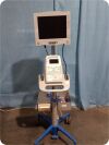 SONOSITE 180 Plus  Portable Ultrasound System